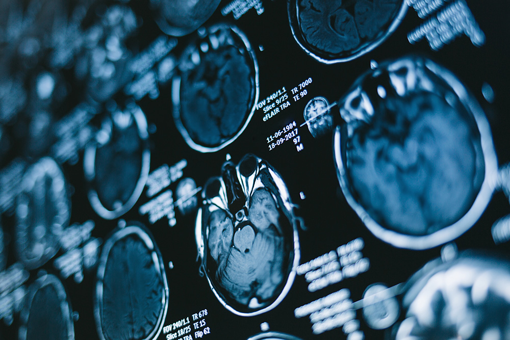 Magnetic resonance scan of the brain. Medicine, science